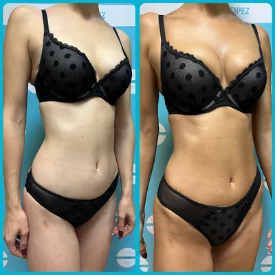 Opalanie Natryskowe Białystok Tan by Ann